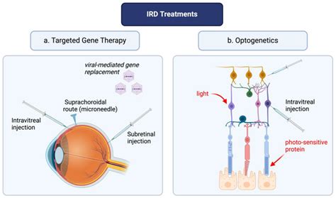 Optogenetics Sustains Vision Recovery for Nearly Three Years in Blind Patients